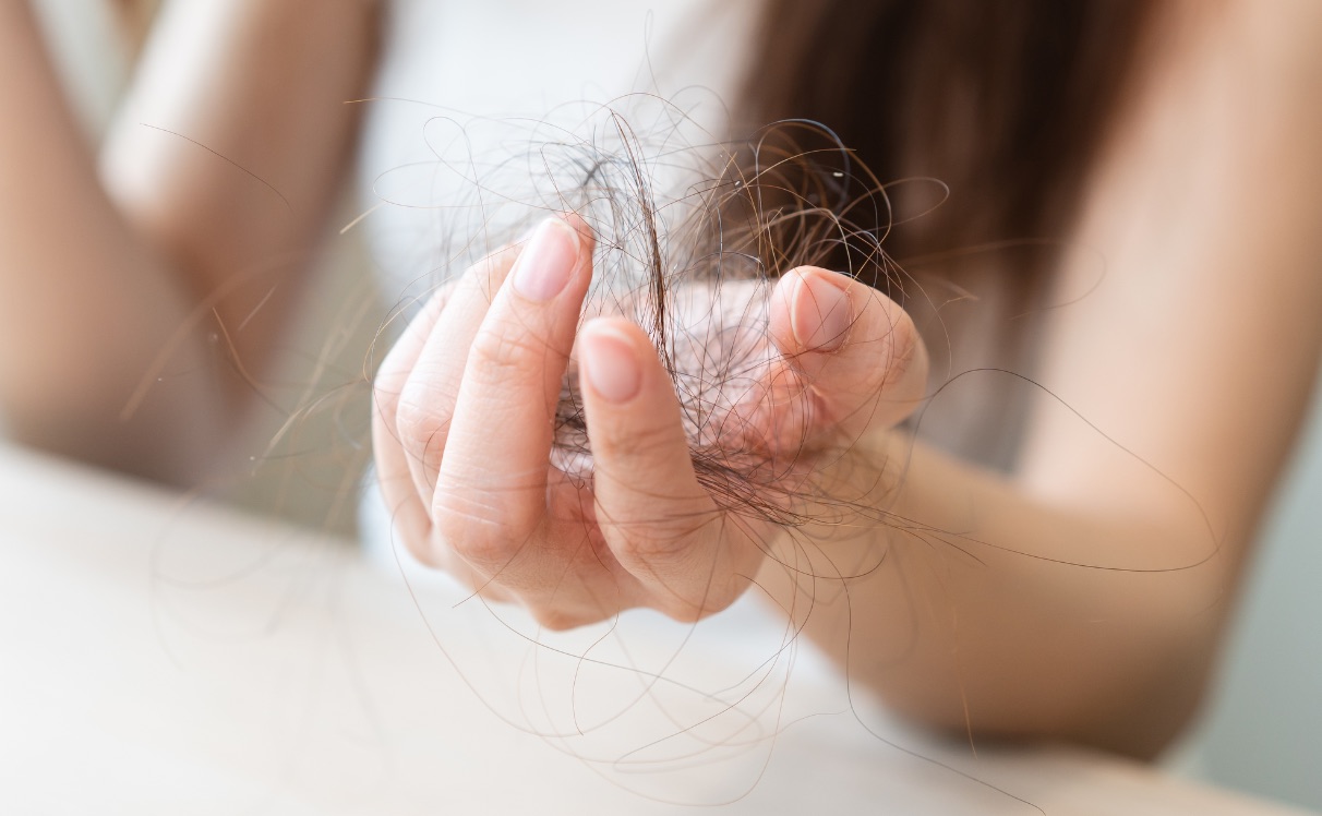 Queda de cabelo no fim do verão: causas, sinais de alerta e medidas de prevenção