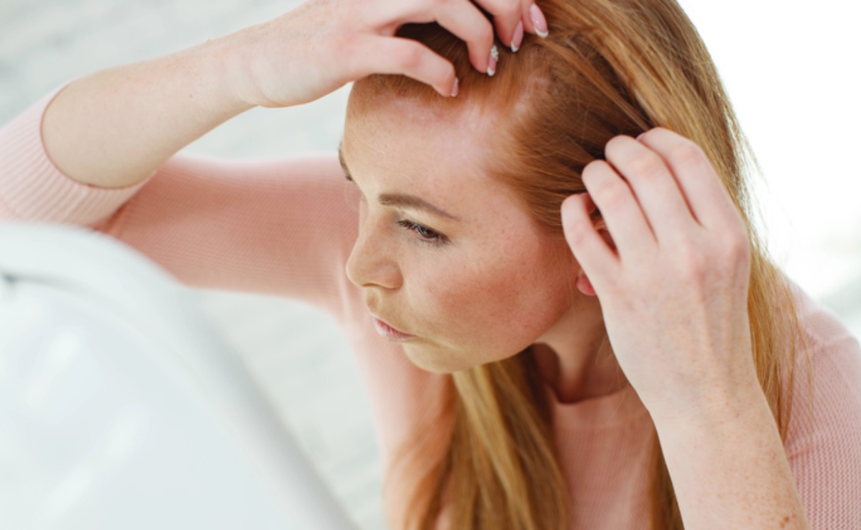 Female Hair Transplant: Everything You Need to Know